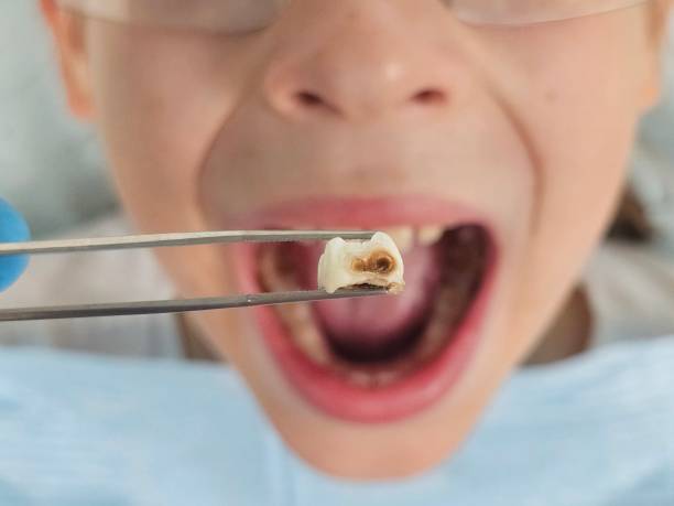 Best Pediatric Emergency Dentist in Washington, GA